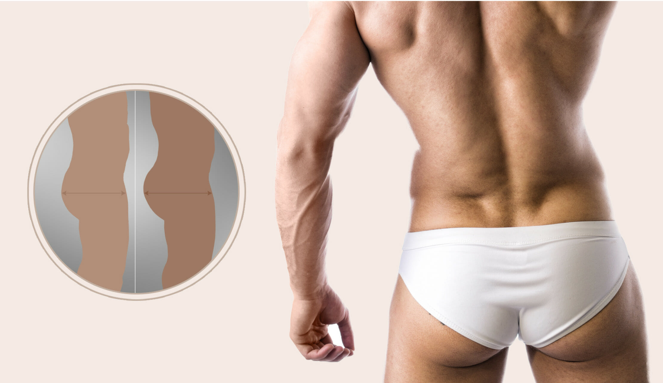 He Got a Booty Enhancement and Everything Changed - OCQ