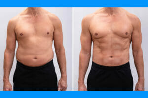 Read more about the article Want to Lose Weight? Knowledge is Power