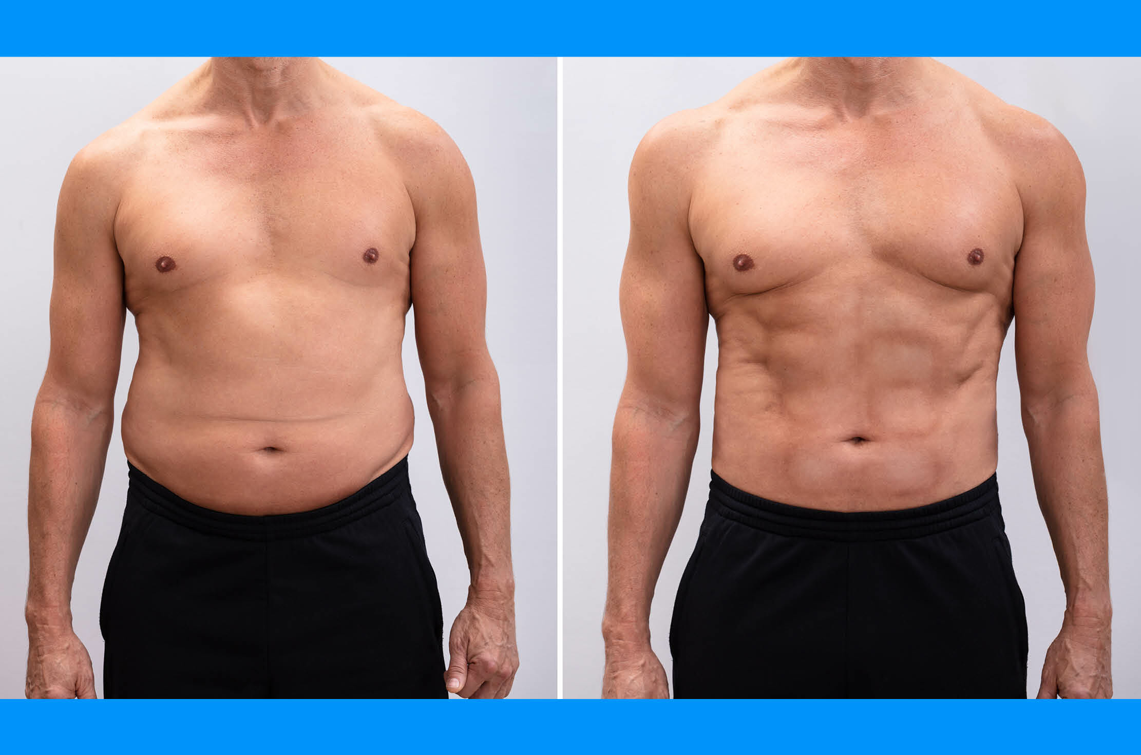 Read more about the article Want to Lose Weight? Knowledge is Power