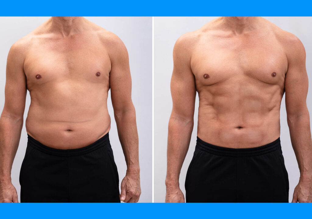Genesis_Lose Weight